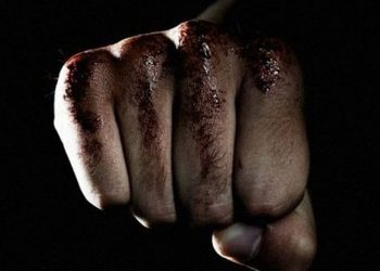 Σε κρίσιμη κατάσταση οπαδός του ΠΑΟΚ που δέχθηκε επίθεση στα Εξάρχεια – Newsbeast