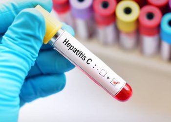 Ηπατίτιδα C: Ενθαρρυντική η αύξηση που παρουσιάζουν οι εξετάσεις για τη νόσο
