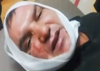 Δάγκωσαν και έκοψαν το αυτί παραγωγού σε λαϊκή αγορά – News.gr