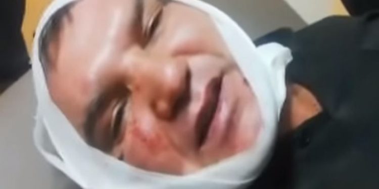 Δάγκωσαν και έκοψαν το αυτί παραγωγού σε λαϊκή αγορά – News.gr