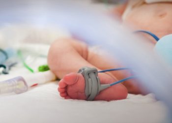 Νεκρό βρέφος από δαγκωματιές σκύλου – News.gr