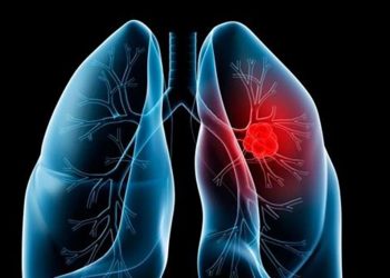 Επιστημονική Διημερίδα για τον Καρκίνο  του Πνεύμονα: «Η Αναπνοή μας, Η Ζωή μας»