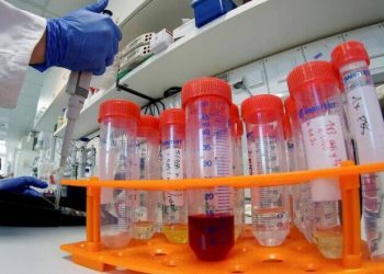 38 νέα κρούσματα στην Ελλάδα, σύνολο 228 – Newsbeast