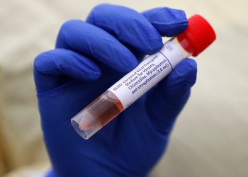 Πέμπτος νεκρός – 35 νέα επιβεβαιωμένα κρούσματα – 387 συνολικά – News.gr