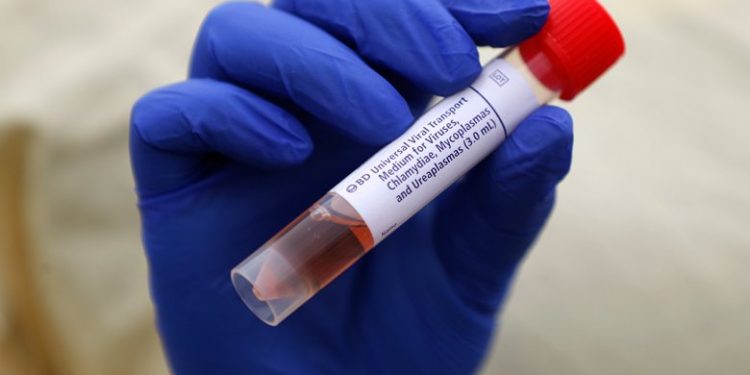 Πέμπτος νεκρός – 35 νέα επιβεβαιωμένα κρούσματα – 387 συνολικά – News.gr