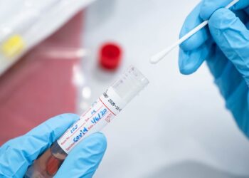 ΔΗΜΟΣ ΑΡΧΑΙΑΣ ΟΛΥΜΠΙΑΣ: Ράπιντ τεστ Covid-19 σε Κακοτάρι, Πανόπουλο, Λάλα και Αρχ. Ολυμπία