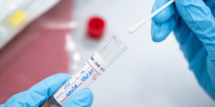ΔΗΜΟΣ ΑΡΧΑΙΑΣ ΟΛΥΜΠΙΑΣ: Ράπιντ τεστ Covid-19 σε Κακοτάρι, Πανόπουλο, Λάλα και Αρχ. Ολυμπία