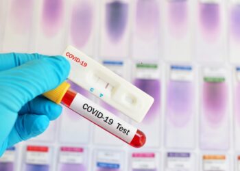 ΔΗΜΟΣ ΑΡΧΑΙΑΣ ΟΛΥΜΠΙΑΣ: Ράπιντ τεστ Covid-19 την Τετάρτη στο Λάλα