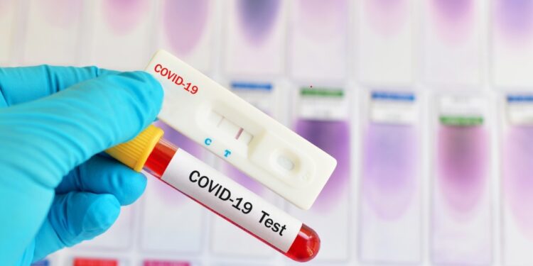 ΔΗΜΟΣ ΑΡΧΑΙΑΣ ΟΛΥΜΠΙΑΣ: Ράπιντ τεστ Covid-19 την Τετάρτη στο Λάλα