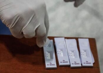 ΔΗΜΟΣ ΑΝΔΡΑΒΙΔΑΣ – ΚΥΛΛΗΝΗΣ: Δωρεάν εξέταση rapid test αύριο Τρίτη (01/03) στα Λεχαινά και Παρασκευή (04/03) στη Βάρδα