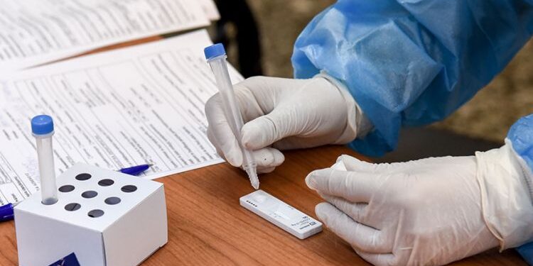 Ράπιντ τεστ Covid-19 σήμερα στην Αρχαία Ολυμπία