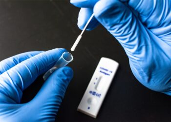 Ράπιντ τεστ Covid-19 σήμερα στην Αρχαία Ολυμπία