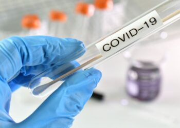 Ράπιντ τεστ Covid-19 σήμερα στην Αρχαία Ολυμπία