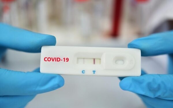 ΔΗΜΟΣ ΑΝΔΡΙΤΣΑΙΝΑΣ – ΚΡΕΣΤΕΝΩΝ: Δωρεάν rapid test αύριο σε Μακρίσια – Καλλίκωμο